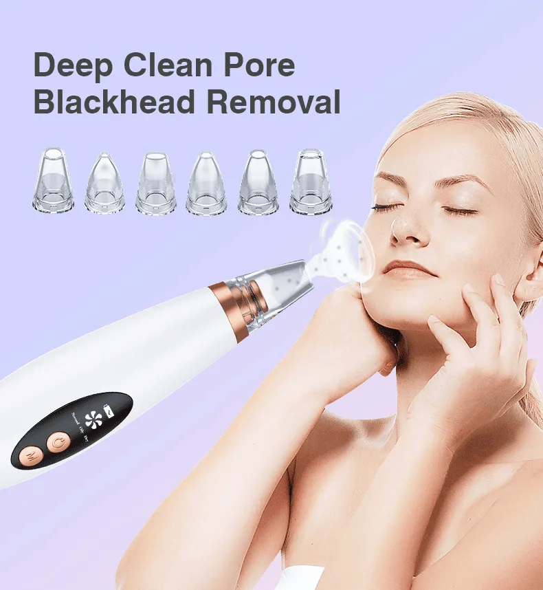 Blackhead Remover
